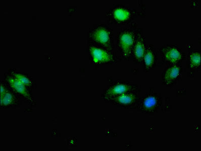Immunofluorescent analysis of A549 cells using IKBKB Antibody at dilution of 1:100 and Alexa Fluor 488-congugated AffiniPure Goat Anti-Rabbit IgG(H+L)