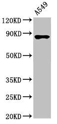 Western Blot  | Positive WB detected in: A549 whole cell lysate  | All lanes: IKBKB antibody at 3.4µg/ml  | Secondary  | Goat polyclonal to rabbit IgG at 1/50000 dilution  | Predicted band size: 87, 86, 30, 80 kDa  | Observed band size: 87 kDa