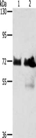 Gel: 6%SDS-PAGE, Lysate: 40 μg, Lane 1-2: Hela cells, Raji cells, Primary antibody: BRAF Antibody(BRAF Antibody) at dilution 1/400, Secondary antibody: Goat anti rabbit IgG at 1/8000 dilution, Exposure time: 1 minute