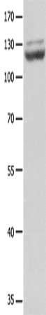 Gel: 8%SDS-PAGE, Lysate: 40μg, Lane: Human brain malignant glioma tissue, Primary antibody: CDH1 Antibody(CDH1 Antibody) at dilution 1/1750, Secondary antibody: Goat anti rabbit IgG at 1/8000 dilution, Exposure time: 1 minuteRabbit anti-Human CDH1 Polyclonal Antibody