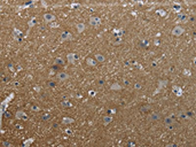 The image on the left is immunohistochemistry of paraffin-embedded Human brain  tissue using GNG2 Antibody(GNG2 Antibody) at dilution 1/50, on the right is treated with fusion protein. (Original magnification: ×200)Rabbit anti-Human GNG2 Polyclonal Antibody