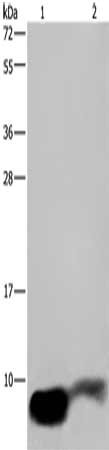Gel: 10%SDS-PAGE, Lysate: 40 μg, Lane 1-2: Human fetal brain tissue, mouse brain tissue, Primary antibody: GNG2 Antibody(GNG2 Antibody) at dilution 1/350, Secondary antibody: Goat anti rabbit IgG at 1/8000 dilution, Exposure time: 2 minutesRabbit anti-Human GNG2 Polyclonal Antibody