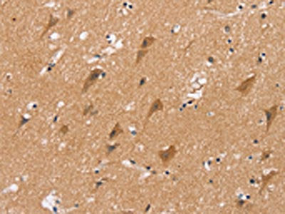 The image on the left is immunohistochemistry of paraffin-embedded Human brain  tissue using MSMB Antibody(MSMB Antibody) at dilution 1/20, on the right is treated with fusion protein. (Original magnification: ×200)Rabbit anti-Human MSMB Polyclonal Antibody