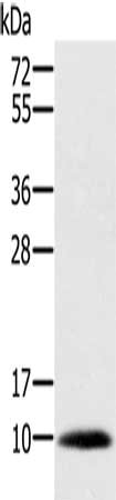 Gel: 10%SDS-PAGE, Lysate: 40 μg, Lane: Human prostate tissue, Primary antibody: MSMB Antibody(MSMB Antibody) at dilution 1/200, Secondary antibody: Goat anti rabbit IgG at 1/8000 dilution, Exposure time: 1 secondRabbit anti-Human MSMB Polyclonal Antibody