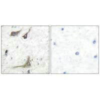 Immunohistochemical analysis of paraffin-embedded human brain tissue using COX1 antibody.Rabbit anti-Human PTGS1 Polyclonal Antibody
