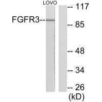 Western blot analysis of extracts from LOVO cells, using FGFR3 antibody.Rabbit anti-Human FGFR3 Polyclonal Antibody