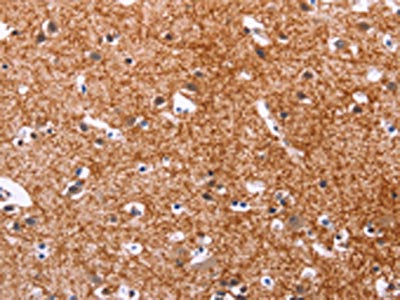 The image on the left is immunohistochemistry of paraffin-embedded Human brain  tissue using APMAP Antibody(APMAP Antibody) at dilution 1/30, on the right is treated with synthetic peptide. (Original magnification: ×200)Rabbit anti-Human APMAP Polyclonal Antibody