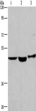 Gel: 8%SDS-PAGE, Lysate: 40 μg, Lane 1-3: Human placenta tissue, Human fetal liver tissue, 231 cells, Primary antibody: APMAP Antibody(APMAP Antibody) at dilution 1/400, Secondary antibody: Goat anti rabbit IgG at 1/8000 dilution, Exposure time: 1 minuteRabbit anti-Human APMAP Polyclonal Antibody