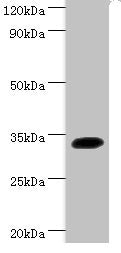 Western blot | All lanes: Transcription factor SOX-2 antibody at 2μg/ml + Mouse kidney tissue | Secondary | Goat polyclonal to rabbit IgG at 1/15000 dilution | Predicted band size: 34 kDa | Observed band size: 34 kDaRabbit anti-Human SOX2 Polyclonal Antibody