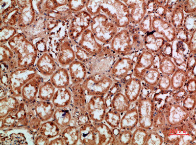 Immunohistochemical analysis of paraffin-embedded human-kidney, antibody was diluted at 1:200Rabbit anti-Human REL Polyclonal Antibody