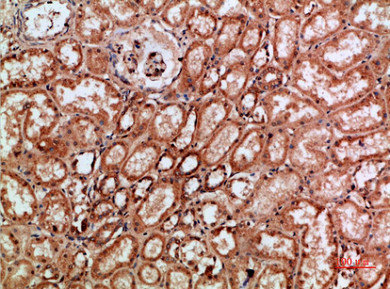Immunohistochemical analysis of paraffin-embedded human-kidney, antibody was diluted at 1:200Rabbit anti-Human REL Polyclonal Antibody