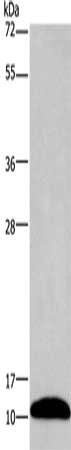 Gel: 12%SDS-PAGE, Lysate: 40 μg, Lane: Mouse brain tissue, Primary antibody: PCP4 Antibody(PCP4 Antibody) at dilution 1/1000, Secondary antibody: Goat anti rabbit IgG at 1/8000 dilution, Exposure time: 2 minutesRabbit anti-Human PCP4 Polyclonal Antibody