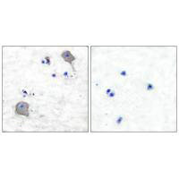 Immunohistochemical analysis of paraffin-embedded human brain tissue using Claudin 5 antibody.Rabbit anti-Human CLDN5 Polyclonal Antibody