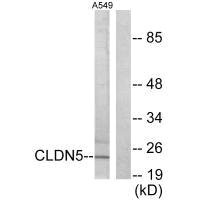 Western blot analysis of extracts from A549 cells, using Claudin 5 antibody.Rabbit anti-Human CLDN5 Polyclonal Antibody