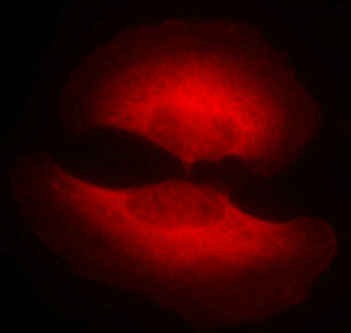 Immunofluorescence staining of methanol-fixed Hela cells showing cytoplasmic staining using GSK3β(Phospho-Ser9) Antibody.Rabbit anti-Human GSK3B Polyclonal Antibody