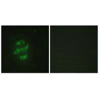 Immunofluorescence analysis of HepG2 cells, using Cytochrome P450 2J2 antibody.Rabbit anti-Human CYP2J2 Polyclonal Antibody