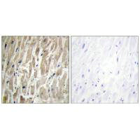 Immunohistochemistry analysis of paraffin-embedded human heart tissue using Cytochrome P450 2J2 antibody.Rabbit anti-Human CYP2J2 Polyclonal Antibody