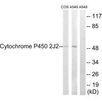 Western blot analysis of extracts from A549 cells, RAW264.7 cells and NIH-3T3 cells, using Cytochrome P450 2J2 antibody.Rabbit anti-Human CYP2J2 Polyclonal Antibody
