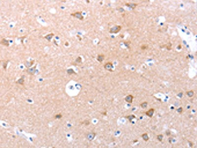 The image on the left is immunohistochemistry of paraffin-embedded Human brain tissue using the antibody Antibody) at dilution 1/30, on the right is treated with synthetic peptide. (Original magnification: ×200)Rabbit anti-Human SPAG4 Polyclonal Antibody