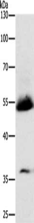 Gel: 10%SDS-PAGE, Lysate: 40 μg, Lane: Human seminoma tissue, Primary antibody: SPAG4 Antibody(SPAG4 Antibody) at dilution 1/600, Secondary antibody: Goat anti rabbit IgG at 1/8000 dilution, Exposure time: 2 minutesRabbit anti-Human SPAG4 Polyclonal Antibody