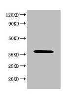 Western Blot  | Positive WB detected in: 293T whole cell lysate  | All lanes: MAPK8 antibody at 6µg/ml  | Secondary  | Goat polyclonal to rabbit IgG at 1/50000 dilution  | Predicted band size: 49, 45, 36 KDa  | Observed band size: 36 KDa