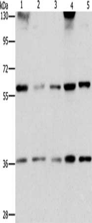 Gel: 6%SDS-PAGE, Lysate: 40 μg, Lane 1-5: PC3 cells, hela cells, human bladder carcinoma tissue, A172 cells, hepG2 cells, Primary antibody: STK4 Antibody(STK3/STK4 Antibody) at dilution 1/1000, Secondary antibody: Goat anti rabbit IgG at 1/8000 dilution, Exposure time: 10 secondsRabbit anti-Human STK4 Polyclonal Antibody