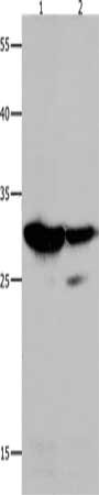 Gel: 10%SDS-PAGE, Lysate: 30 μg, Lane 1-2: 231 cells, Hela cells, Primary antibody: LGALS3 Antibody(LGALS3 Antibody) at dilution 1/100, Secondary antibody: Goat anti rabbit IgG at 1/8000 dilution, Exposure time: 90 seconds