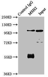 Immunoprecipitating MSH2 in 293 whole cell lysate | Lane 1: Rabbit control IgG instead of MSH2 Antibody in 293 whole cell lysate. | For western blotting, a HRP-conjugated Protein G antibody was used as the secondary antibody (1/2000) | Lane 2: MSH2 Antibody (6μg) + 293 whole cell lysate (1mg) | Lane 3: 293 whole cell lysate (20μg)Rabbit anti-Human MSH2 Polyclonal Antibody