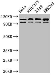 Western Blot | Positive WB detected in: Hela whole cell lysate, NIH/3T3 whole cell lysate, A549 whole cell lysate, HEK293 whole cell lysate | All lanes: MSH2 antibody at 2μg/ml | Secondary | Goat polyclonal to rabbit IgG at 1/50000 dilution | Predicted band size: 105, 98 kDa | Observed band size: 105, 98 kDa
