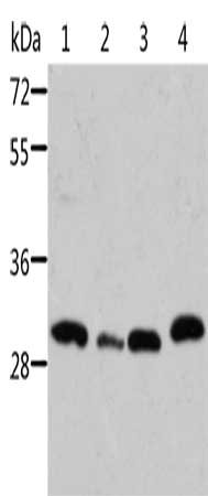 Gel: 10%SDS-PAGE, Lysate: 40 μg, Lane 1-4: Mouse pancreas tissue, Mouse spleen tissue, mouse heart tissue, 293T cells, Primary antibody: STRADB Antibody(STRADB Antibody) at dilution 1/500, Secondary antibody: Goat anti rabbit IgG at 1/8000 dilution, Exposure time: 10 minutesRabbit anti-Human STRADB Polyclonal Antibody