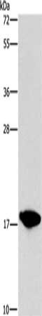 Gel: 15%SDS-PAGE, Lysate: 40 μg, Lane: HepG2 cells, Primary antibody: CCL16 Antibody(CCL16  Antibody) at dilution 1/760, Secondary antibody: Goat anti rabbit IgG at 1/8000 dilution, Exposure time: 3 seconds