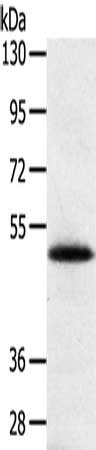 Gel: 8%SDS-PAGE, Lysate: 40 μg, Lane: Human placenta tissue, Primary antibody: SMOC2 Antibody(SMOC2 Antibody) at dilution 1/250, Secondary antibody: Goat anti rabbit IgG at 1/8000 dilution, Exposure time: 5 minutesRabbit anti-Human SMOC2 Polyclonal Antibody
