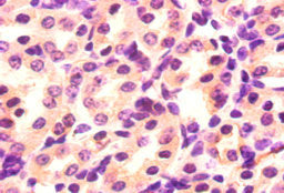 Immunohistochemistry of paraffin-embedded mouse kidney tissue using Angpt2 Antibody at dilution of 1:50Rabbit anti-Mus musculus (Mouse) Angpt2 Polyclonal Antibody