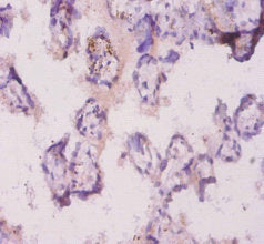 Immunohistochemistry of paraffin-embedded human placenta tissue using Angpt2 Antibody at dilution of 1:20Rabbit anti-Mus musculus (Mouse) Angpt2 Polyclonal Antibody