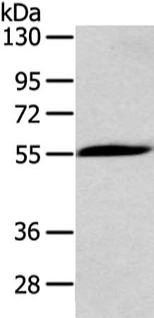 Gel: 8%SDS-PAGE, Lysate: 60 μg, Lane: Mouse heart tissue, Primary antibody: CHRNA1 Antibody(CHRNA1 Antibody) at dilution 1/200 dilution, Secondary antibody: Goat anti rabbit IgG at 1/8000 dilution, Exposure time: 3 minutesRabbit anti-Human CHRNA1 Polyclonal Antibody
