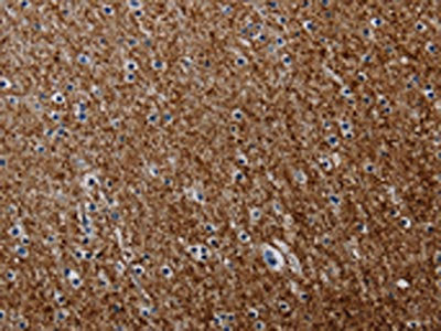 The image on the left is immunohistochemistry of paraffin-embedded Human brain tissue using the antibody Antibody) at dilution 1/50, on the right is treated with synthetic peptide. (Original magnification: ×200)Rabbit anti-Human PCDHAC1 Polyclonal Antibody