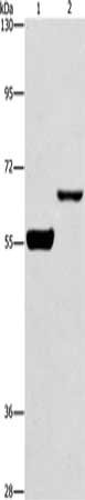 Gel: 6%SDS-PAGE, Lysate: 40 μg, Lane 1-2: Mouse brain tissue, RAW264.7 cells, Primary antibody: CDC25B Antibody(CDC25B  Antibody) at dilution 1/250, Secondary antibody: Goat anti rabbit IgG at 1/8000 dilution, Exposure time: 20 secondsRabbit anti-Human CDC25B Polyclonal Antibody