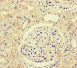 Immunohistochemistry of paraffin-embedded human kidney tissue using MLH1 Antibody at dilution of 1:100Rabbit anti-Human MLH1 Polyclonal Antibody