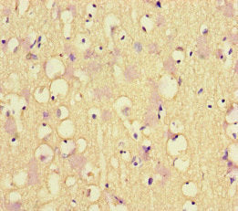 Immunohistochemistry of paraffin-embedded human brain tissue using MLH1 Antibody at dilution of 1:100Rabbit anti-Human MLH1 Polyclonal Antibody
