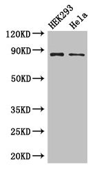 Western Blot | Positive WB detected in: HEK293 whole cell lysate, Hela whole cell lysate | All lanes: MLH1 antibody at 3μg/ml | Secondary | Goat polyclonal to rabbit IgG at 1/50000 dilution | Predicted band size: 85, 59, 74 kDa | Observed band size: 85 kDaRabbit anti-Human MLH1 Polyclonal Antibody