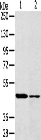 Gel: 8%SDS-PAGE, Lysate: 40 μg, Lane 1-2: 293T cells, lovo cells, Primary antibody: SCD Antibody(SCD Antibody) at dilution 1/200, Secondary antibody: Goat anti rabbit IgG at 1/8000 dilution, Exposure time: 1 minuteRabbit anti-Human SCD Polyclonal Antibody