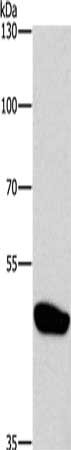 Gel: 8%SDS-PAGE, Lysate: 40 μg, Lane: Mouse brain tissue, Primary antibody: CTBP1 Antibody(CTBP1 Antibody) at dilution 1/500, Secondary antibody: Goat anti rabbit IgG at 1/8000 dilution, Exposure time: 3 minutesRabbit anti-Human CTBP1 Polyclonal Antibody
