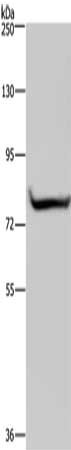 Gel: 6%SDS-PAGE, Lysate: 40 μg, Lane: 293T cells, Primary antibody: GYS1 Antibody(GYS1 Antibody) at dilution 1/300, Secondary antibody: Goat anti rabbit IgG at 1/8000 dilution, Exposure time: 20 secondsRabbit anti-Human GYS1 Polyclonal Antibody