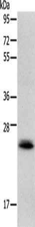 Gel: 12%SDS-PAGE, Lysate: 40 μg, Lane: Mouse heart tissue, Primary antibody: RAB22A Antibody(RAB22A Antibody) at dilution 1/300, Secondary antibody: Goat anti rabbit IgG at 1/8000 dilution, Exposure time: 10 secondsRabbit anti-Human RAB22A Polyclonal Antibody
