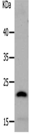 Gel: 10%SDS-PAGE, Lysate: 40 μg, Lane: Human liver cancer tissue, Primary antibody: LCN2 Antibody(LCN2 Antibody) at dilution 1/1050, Secondary antibody: Goat anti rabbit IgG at 1/8000 dilution, Exposure time: 2 minutes