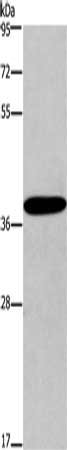 Gel: 8%SDS-PAGE, Lysate: 40 μg, Lane: Mouse skin tissue, Primary antibody: CCR2 Antibody(CCR2 Antibody) at dilution 1/450, Secondary antibody: Goat anti rabbit IgG at 1/8000 dilution, Exposure time: 5 minutesRabbit anti-Human CCR2 Polyclonal Antibody