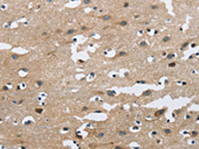 The image on the left is immunohistochemistry of paraffin-embedded Human brain  tissue using FGF9 Antibody(FGF9 Antibody) at dilution 1/40, on the right is treated with fusion protein. (Original magnification: ×200)Rabbit anti-Human FGF9 Polyclonal Antibody