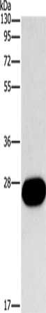 Gel: 10%SDS-PAGE, Lysate: 40 μg, Lane: Mouse kidney tissue, Primary antibody: FGF9 Antibody(FGF9 Antibody) at dilution 1/800, Secondary antibody: Goat anti rabbit IgG at 1/8000 dilution, Exposure time: 20 secondsRabbit anti-Human FGF9 Polyclonal Antibody