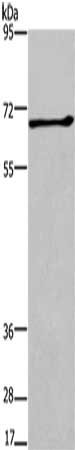 Gel: 6%SDS-PAGE, Lysate: 40 μg, Lane: Mouse thymus tissue, Primary antibody: ALCAM Antibody(ALCAM Antibody) at dilution 1/200, Secondary antibody: Goat anti rabbit IgG at 1/8000 dilution, Exposure time: 2 minutesRabbit anti-Human ALCAM Polyclonal Antibody
