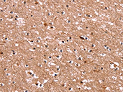 The image on the left is immunohistochemistry of paraffin-embedded Human brain  tissue using BCL6 Antibody(BCL6 Antibody) at dilution 1/15, on the right is treated with synthetic peptide. (Original magnification: ×200)